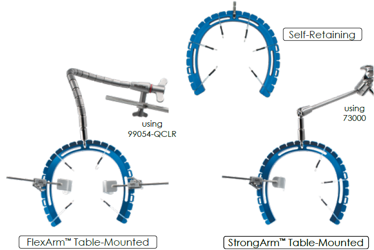 Dynatrack Horseshoe Configurations